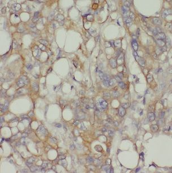 CHRNB1 Rabbit Polyclonal Antibody