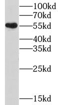 CHRNB4 Rabbit Polyclonal Antibody