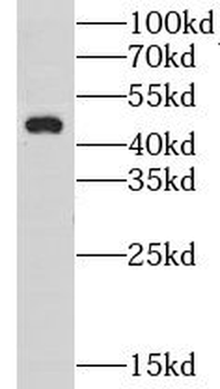 CHST12 Rabbit Polyclonal Antibody