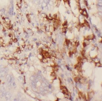 CHST12 Rabbit Polyclonal Antibody