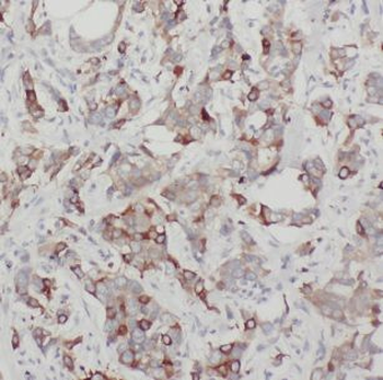 CHST3 Rabbit Polyclonal Antibody