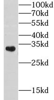 CHST8 Rabbit Polyclonal Antibody