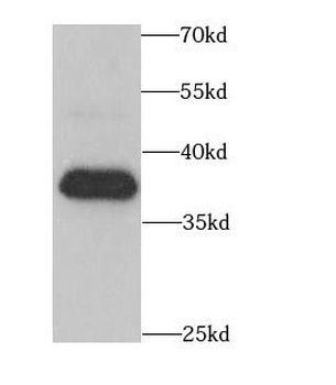 CIAPIN1 Antibody