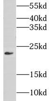 CIB4 Rabbit Polyclonal Antibody