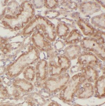 CIB4 Rabbit Polyclonal Antibody