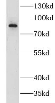 CILP2 Rabbit Polyclonal Antibody