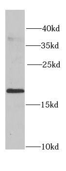 CIRBP Rabbit Polyclonal Antibody