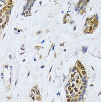CIRBP Rabbit Polyclonal Antibody