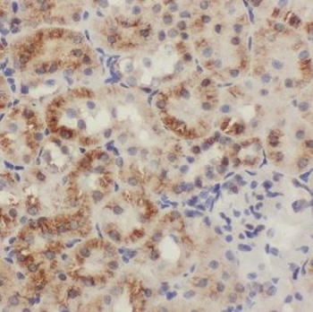 CISD2 Rabbit Polyclonal Antibody