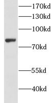 CKAP2 Rabbit Polyclonal Antibody