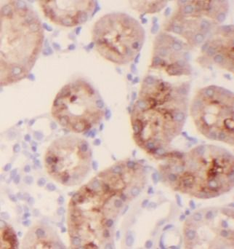 CKAP4 Rabbit Polyclonal Antibody