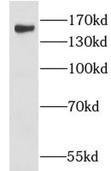 CLASP2 Rabbit Polyclonal Antibody
