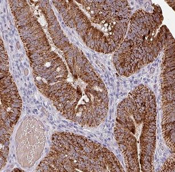 CLDN23 Rabbit Polyclonal Antibody