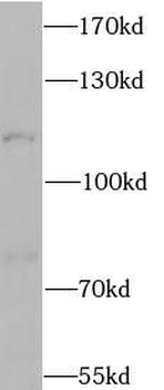 CLCN1 Rabbit Polyclonal Antibody