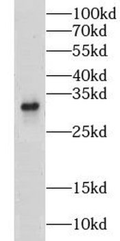 CLEC1A Antibody