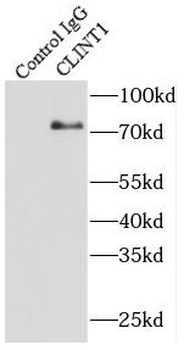 CLINT1 Rabbit Polyclonal Antibody