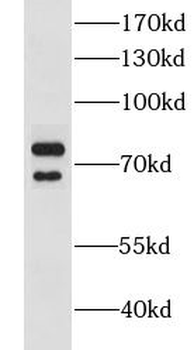 CLINT1 Rabbit Polyclonal Antibody