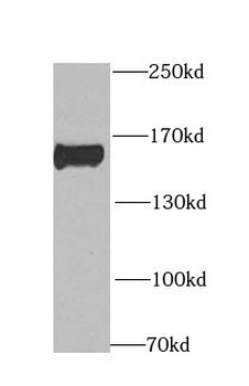 CLIP1 Rabbit Polyclonal Antibody