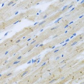 CLIP1 Rabbit Polyclonal Antibody