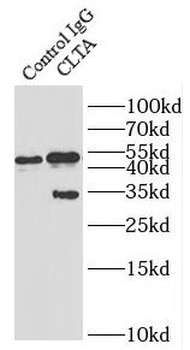 CLTA Rabbit Polyclonal Antibody