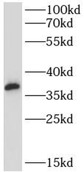 CLTA Rabbit Polyclonal Antibody
