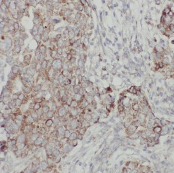 CLTA Rabbit Polyclonal Antibody