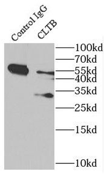 CLTB Rabbit Polyclonal Antibody
