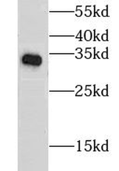 CLTB Rabbit Polyclonal Antibody