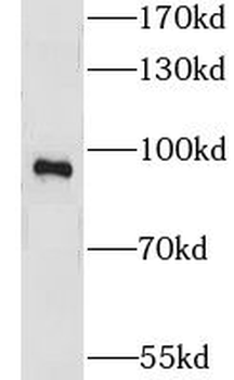 CNGA3 Rabbit Polyclonal Antibody