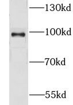 CNNM4 Rabbit Polyclonal Antibody