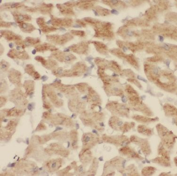 CNOT1 Antibody