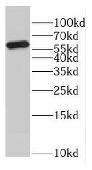COASY Rabbit Polyclonal Antibody