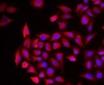 COCH Rabbit Polyclonal Antibody