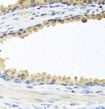 COCH Rabbit Polyclonal Antibody