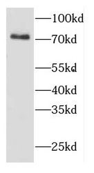COG6 Rabbit Polyclonal Antibody