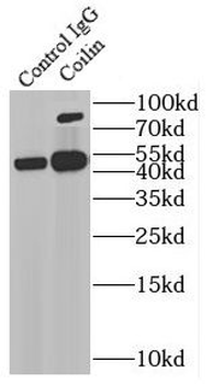 COIL Rabbit Polyclonal Antibody