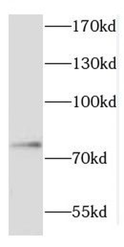 COIL Rabbit Polyclonal Antibody