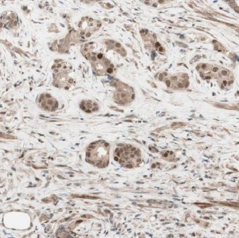 COIL Rabbit Polyclonal Antibody