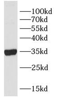 COLEC11 Rabbit Polyclonal Antibody