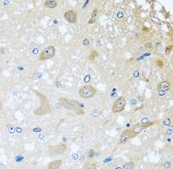 COLEC11 Rabbit Polyclonal Antibody
