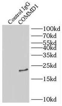 COMMD1 Rabbit Polyclonal Antibody