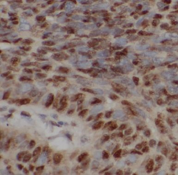COMMD1 Rabbit Polyclonal Antibody