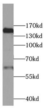 CFH Rabbit Polyclonal Antibody