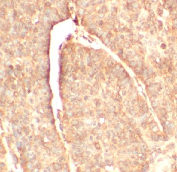 CFH Rabbit Polyclonal Antibody