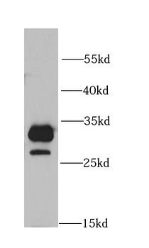 COMT Antibody