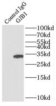 GJB1 Rabbit Polyclonal Antibody