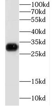 GJB1 Rabbit Polyclonal Antibody