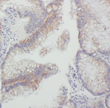 GJB1 Rabbit Polyclonal Antibody