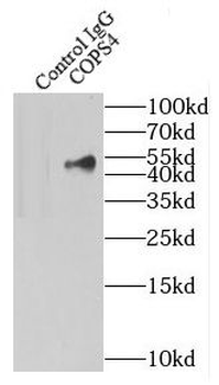 COPS4 Rabbit Polyclonal Antibody