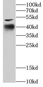 COPS4 Rabbit Polyclonal Antibody